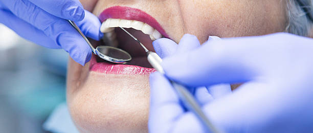Best Emergency Dental Care for Broken or Chipped Teeth in Upper Greenwood Lake, NJ